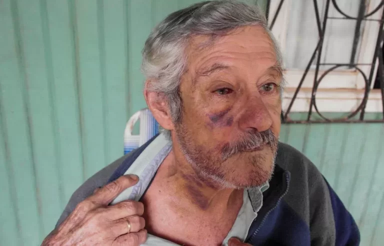 Oberá: “Me golpearon mucho, me pusieron una cadena en la boca y me arrastraron”