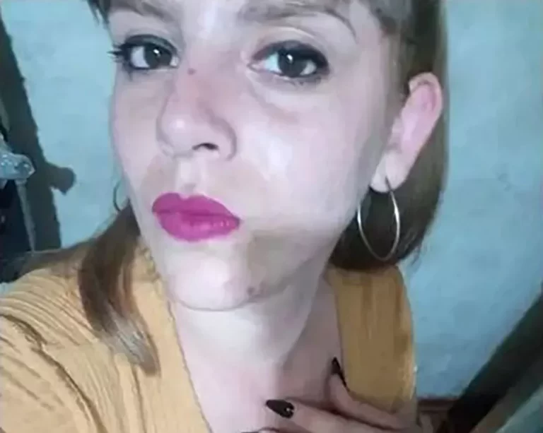 Tragedia en La Matanza: a una joven se le enganchó el pelo en una máquina y murió