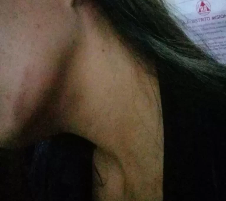 Denunció que fue atacada por un policía y su familia en pleno centro de Iguazú