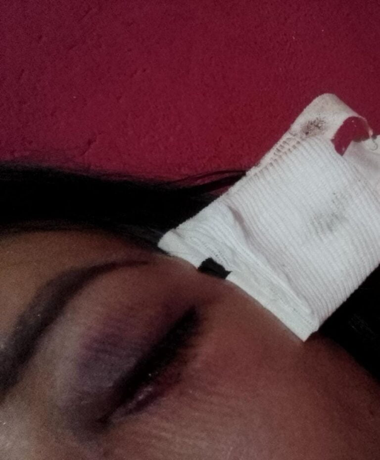 Violencia de Genero en San Javier: “Me empezó a pegar sin decirme nada, me dio varias piñas sin lástima”