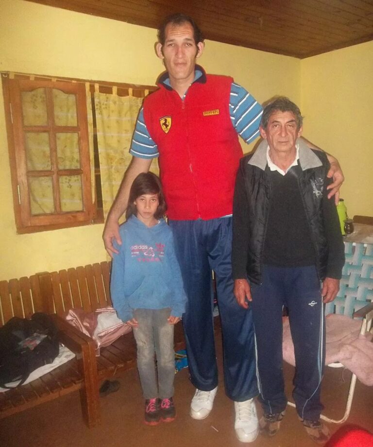 El hombre más alto de Argentina busca ayuda en Candelaria